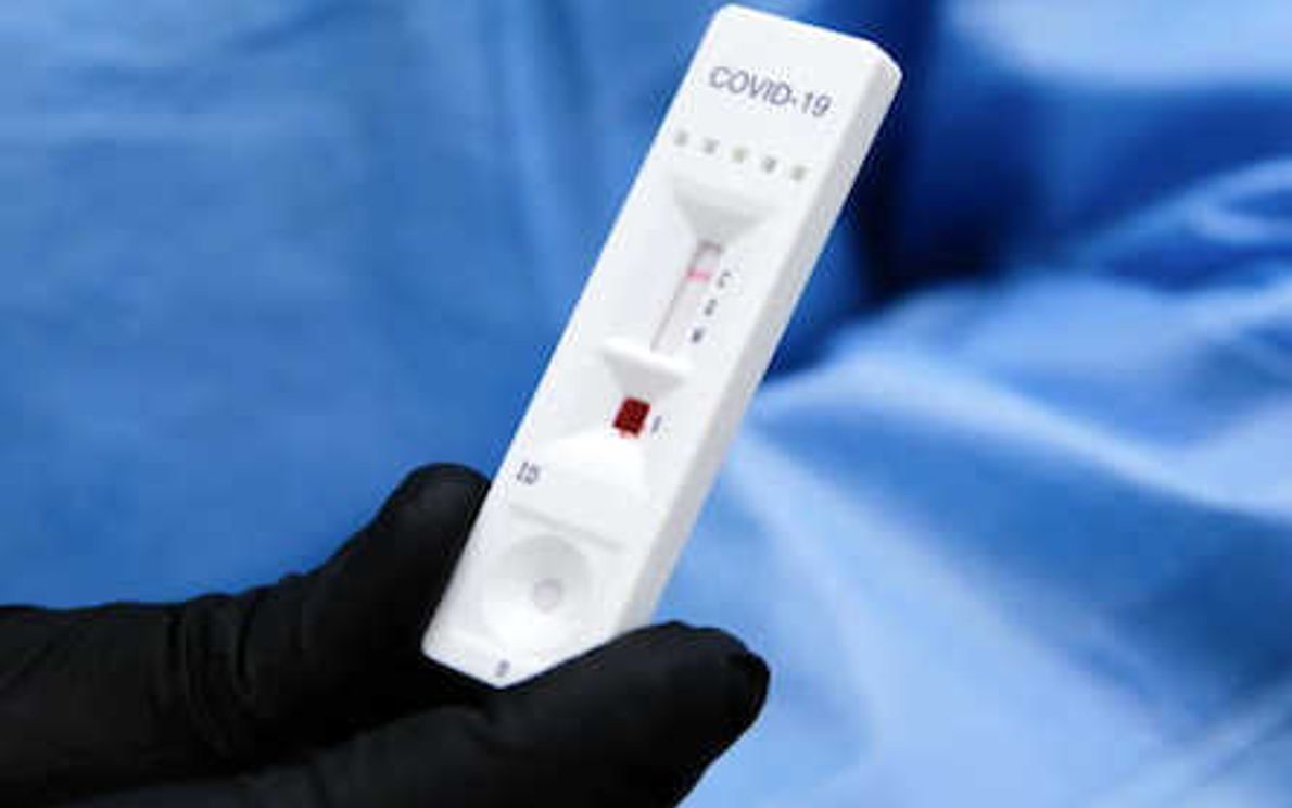 Test sierologico rapido covid19