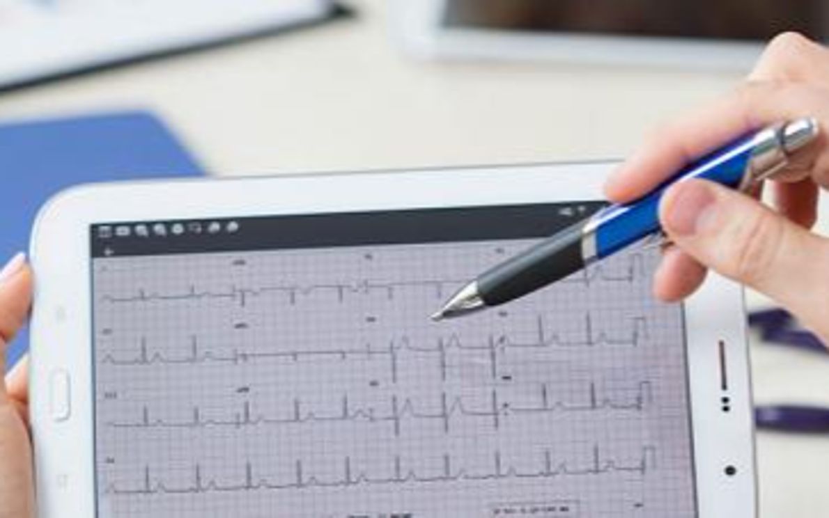 Cardiomiopatia aritmogena, finanziato uno studio